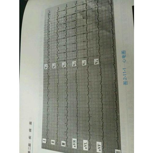 內(nèi)科學(xué)(心血管內(nèi)科分冊）