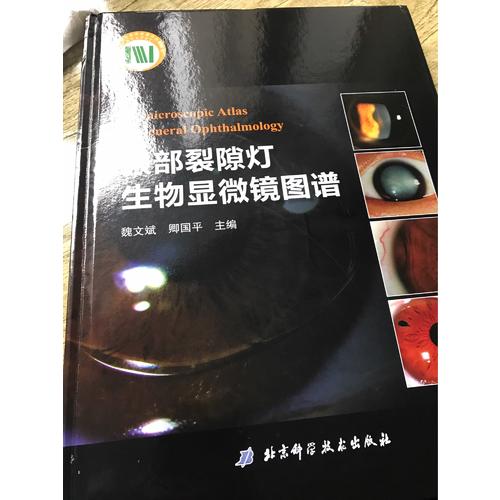 眼部裂隙燈生物顯微鏡圖譜