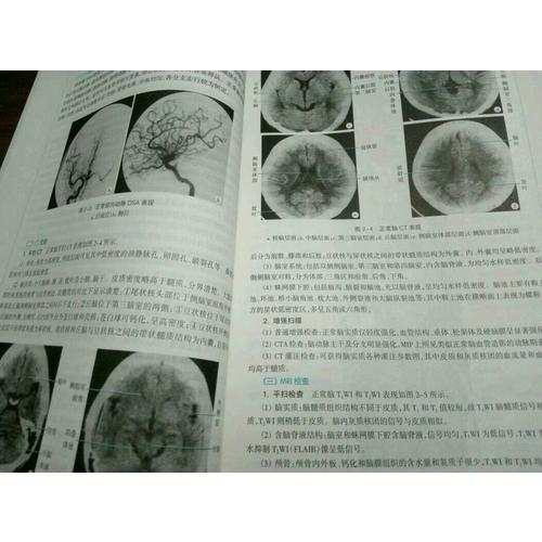 醫學影像學（第七版/本科臨床/十二五規劃）