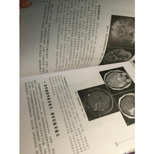 神經內科疾病影像診斷思維（第二版）