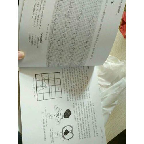 經典心電圖圖譜