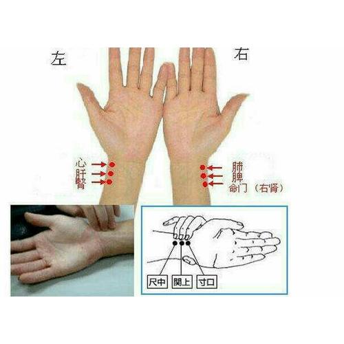 王氏平衡針療法