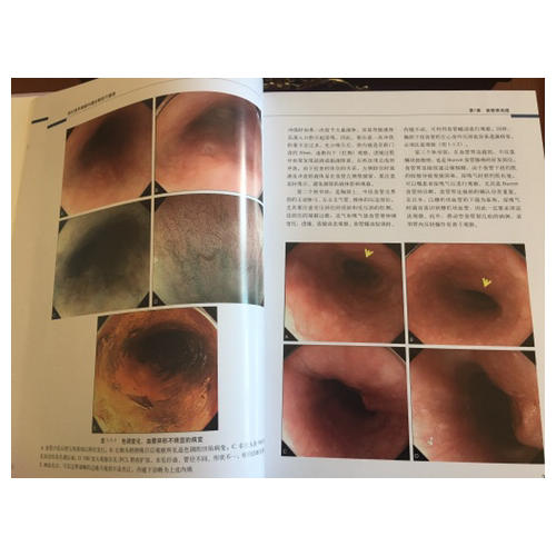 消化道早期癌內鏡診斷技巧圖譜（修訂版）