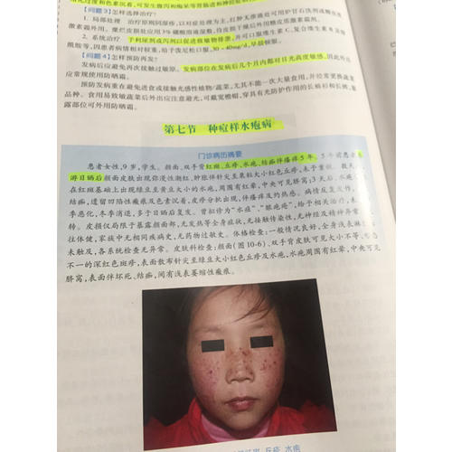 國(guó)家衛(wèi)生和計(jì)劃生育委員會(huì)住院醫(yī)師規(guī)范化培訓(xùn)規(guī)劃教材·皮膚性病學(xué)