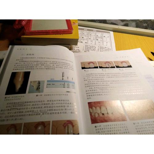 美學修復牙體預備（口腔美學修復實用教程）