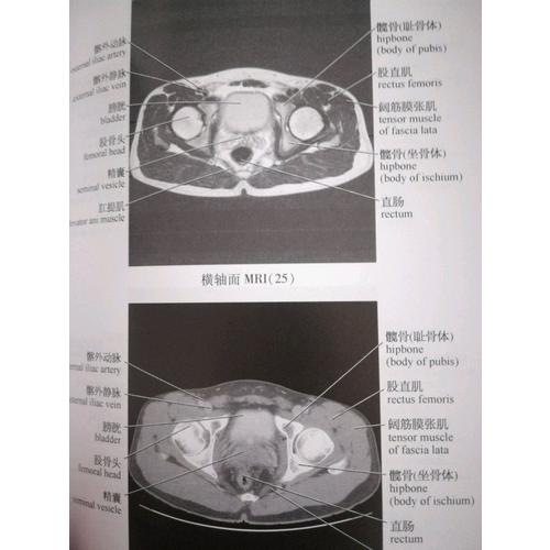 腹部影像解剖圖譜
