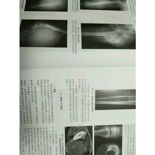 骨與關節損傷影像診斷學（第2版）