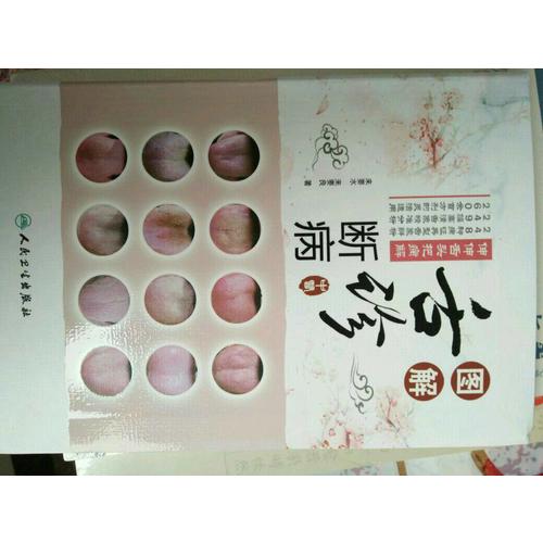 圖解舌診斷病·伸伸舌頭把病解