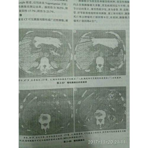 現代代謝與營養性疾病