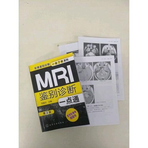 MRI鑒別診斷一點通(第二版)