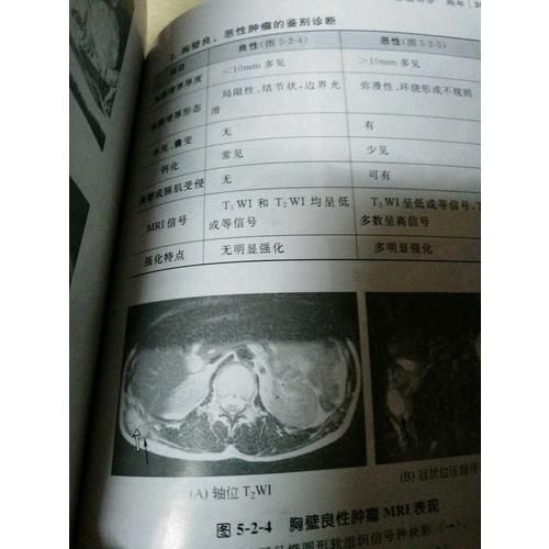 MRI鑒別診斷一點通(第二版)