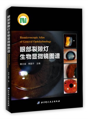 眼部裂隙燈生物顯微鏡圖譜