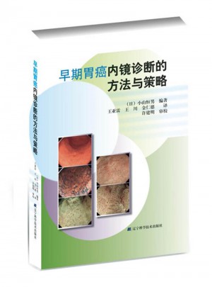 早期胃癌內(nèi)鏡診斷的方法與策略