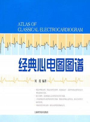 經(jīng)典心電圖圖譜