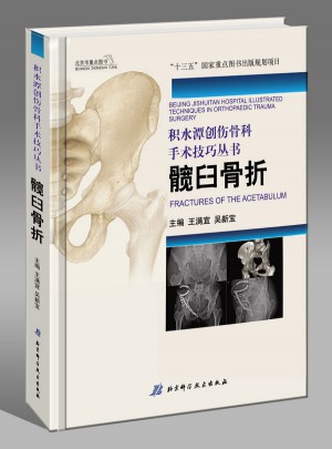 積水潭創傷骨科手術技巧：髖臼骨折
