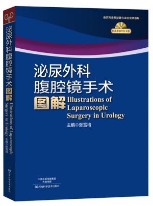 泌尿外科腹腔鏡手術圖解