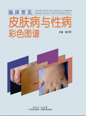 臨床常見皮膚病與性病彩色圖譜
