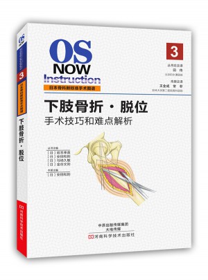 下肢骨折·脫位