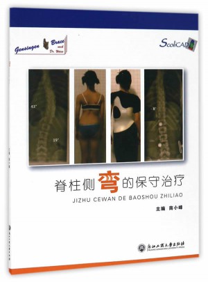 脊柱側彎的保守治療