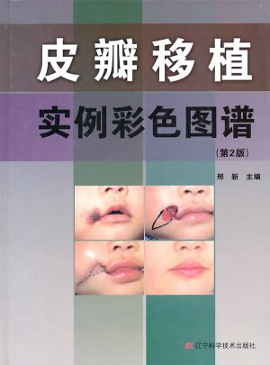 皮瓣移植實例彩色圖譜（第2版）