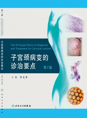 子宮頸病變的診治要點(diǎn)（第2版）