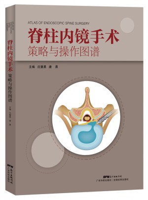 脊柱內(nèi)鏡手術(shù)策略與操作圖譜