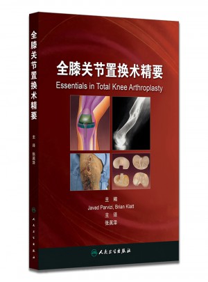 全膝關(guān)節(jié)置換術(shù)精要(翻譯版)