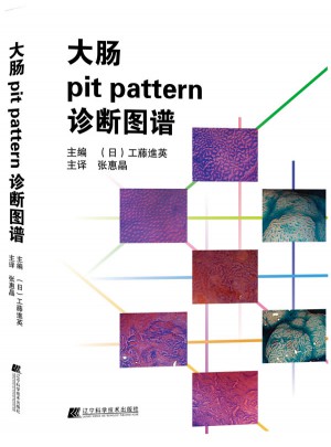 大腸pit pattern診斷圖譜