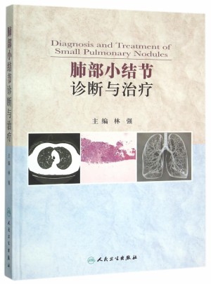 肺部小結(jié)節(jié)診斷與治療(精)