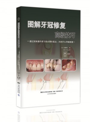 圖解牙冠修復(fù)高級(jí)技巧