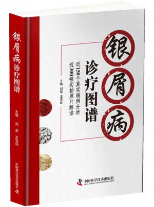 銀屑病診療圖譜