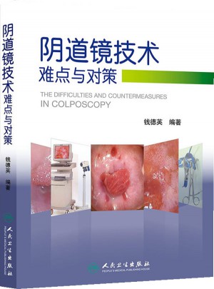 陰道鏡技術難點與對策